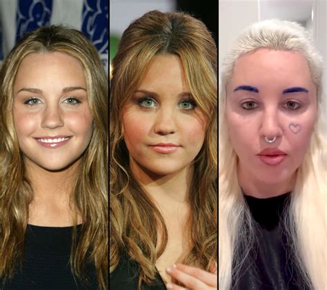 Amanda Bynes Plastic Surgery: Before and After Photos | In Touch Weekly