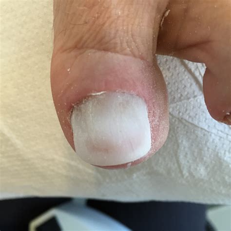 Podiatry - West Strand Clinic Preston