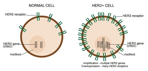 HER2 Receptor and Hormone Receptors ER+ Influence On Breast Cancer