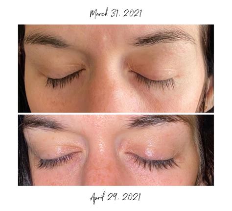 Albums 100+ Pictures Lash Boost Before And After Photos Excellent