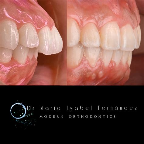 The benefits of having a healthy bite - Smile Studios - Best Medical