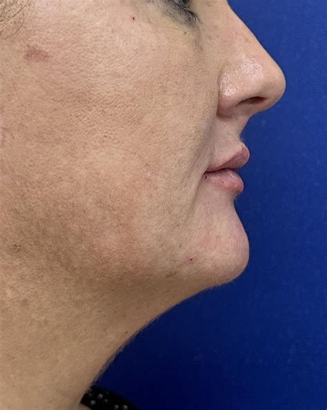 Dr. Andreas Skarparis - Larnaca Center For Plastic Surgery & Hand