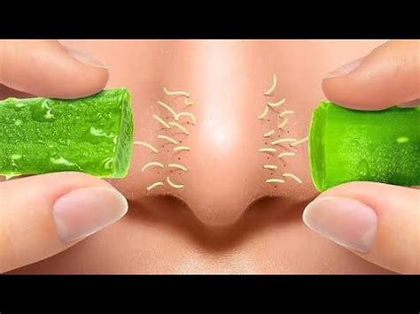 3 Травы/ БАДы , Которые Могут Помочь При Акне - YouTube
