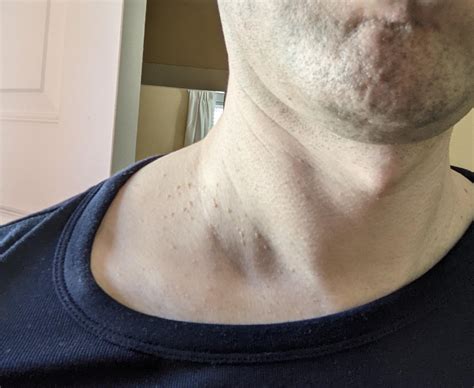 wondering  skin bumps    neck quantity increased