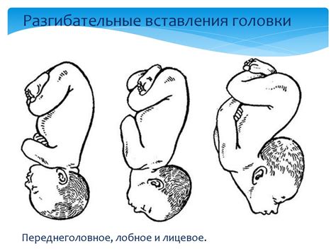 Плод как объект родов. Биомеханизм родов при затылочных предлежаниях ...
