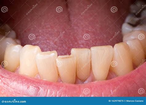 man showing  bottom teeth   dentist stock image image