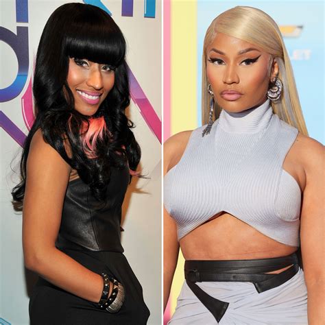 Nicki Minaj Before And After