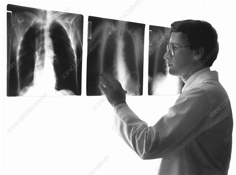 X-ray diagnosis - Stock Image - M415/0462 - Science Photo Library