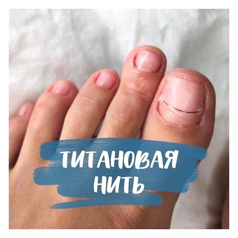 Студия Маникюра - Титановая нить – одна из самых...
