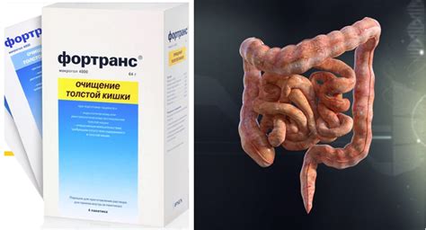 Слабительные средства для очищения кишечника быстрого действия: список ...