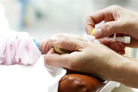 preterm babies   expect dr rahul varma