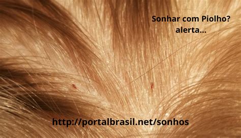 O Que Quer Dizer Sonhar Com Piolhos - Sonhar com Piolho têm Alguns Significados. Atenção Cuidado!
