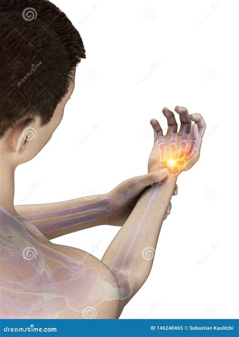 A painful wrist stock illustration. Illustration of health - 146240465