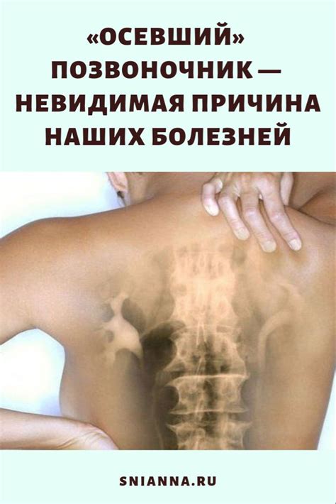 «Осевший» позвоночник — невидимая причина наших болезней | Здоровье ...