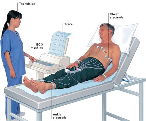 Electrocardiogram (ECG): working principle, normal ECG wave ...