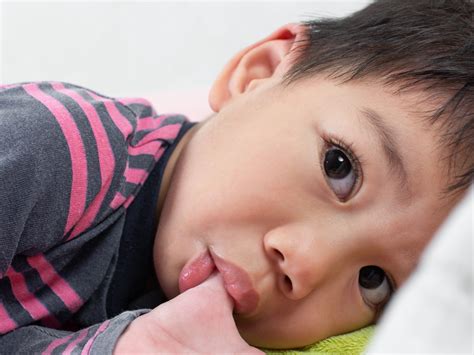 Effects of Thumb Sucking on Teeth - Smile Every Day Dentistry