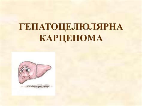 Гепатоцелюлярна карценома - презентация онлайн