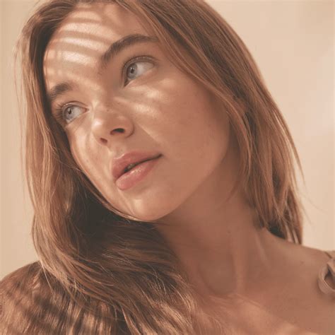 hair dandruff and hair loss 3