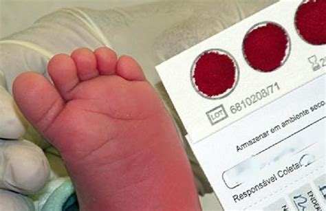 O Que O Teste Do Pezinho Detecta - Brasileiro cria novo teste do pezinho e identifica 50 doenças