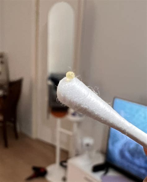 A hard round ball got popped out of my stye. Not even sure what this is