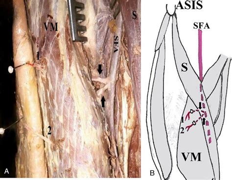 medial view    thigh  square  showing  superficial
