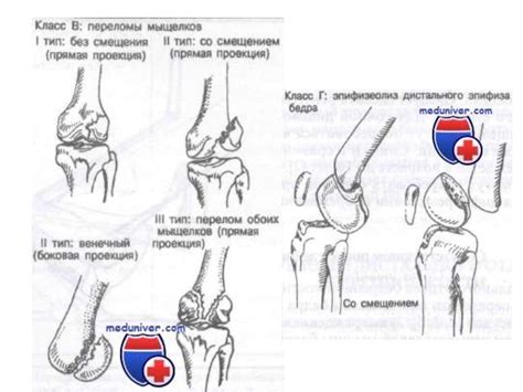 Повреждение органов брюшной полости - презентация онлайн