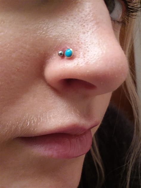 Nostril Piercing Keloid