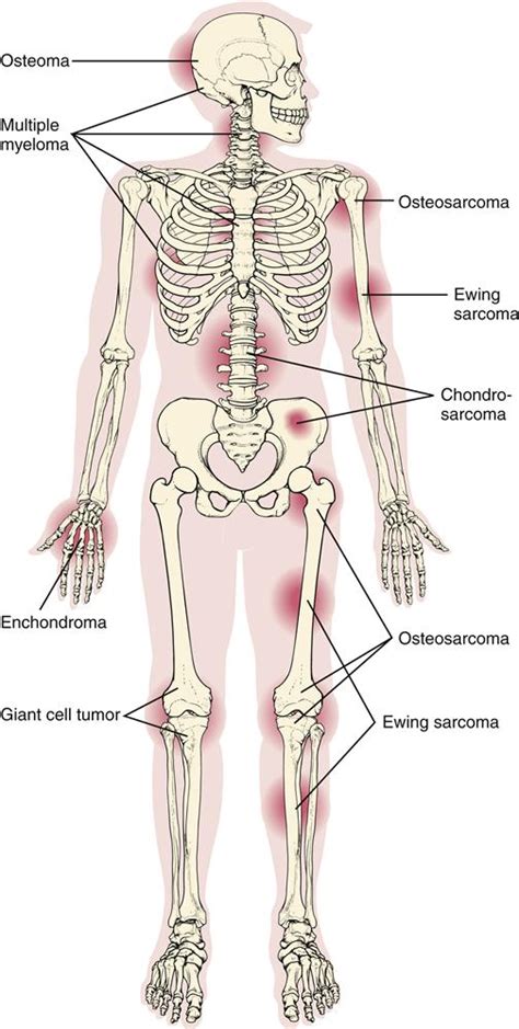 Structure and Function of the Musculoskeletal System | Basicmedical Key
