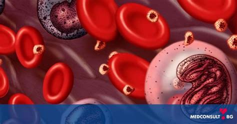Видове левкемия и тяхното лечение — Medconsult.bg