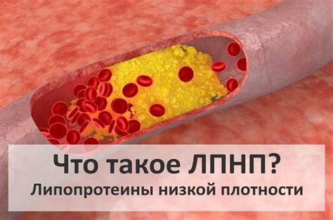 Холестерин ЛПНП повышен: что это значит