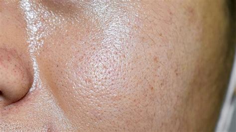 Sebum: What It Is, What It Does, Balancing Production, and More