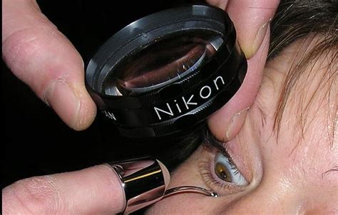 scleral depression