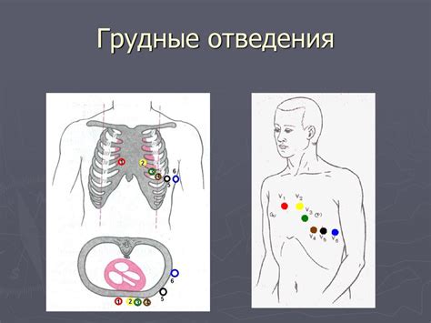 Анализ ЭКГ - презентация онлайн