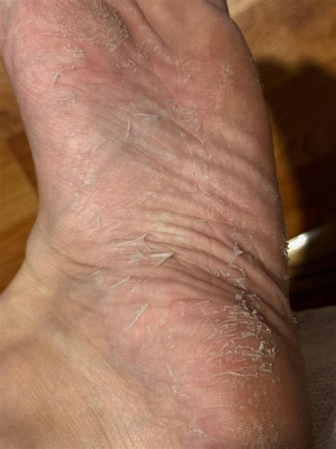 AOA Skin Foot Peeling Mask – Shop Miss A