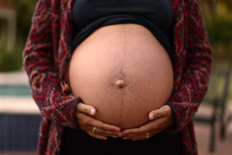 Barriga Com Manchas Escuras - Gravidez Linha Escura Na Barriga - RETOEDU