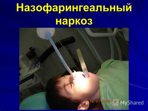 Презентация на тему: "Общая анестезия в детской амбулаторной ...