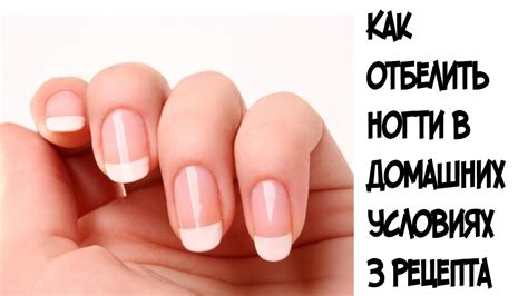 Как отбелить ногти в домашних условиях ///3 самые эффективные маски ...