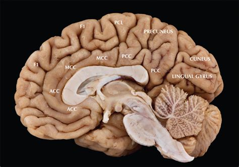 Mri Paracentral Lobule