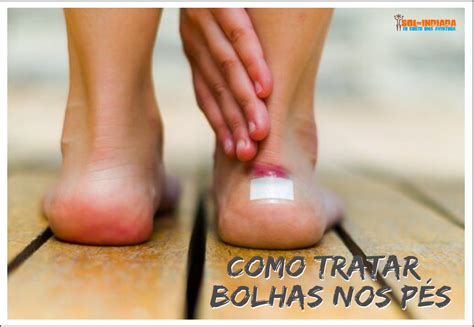 Bolinhas Na Sola Do Pé - COMO TRATAR AS BOLHAS NOS PÉS
