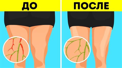 6 простых упражнений для похудения без диет - YouTube