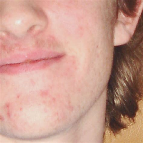 Dermatolog - Specijalistički pregled dermatologa - Poliklinika Konja Zagreb