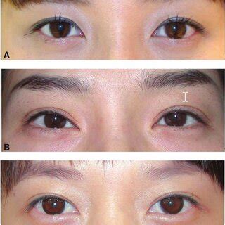 fold   fold  neutral fold   fold