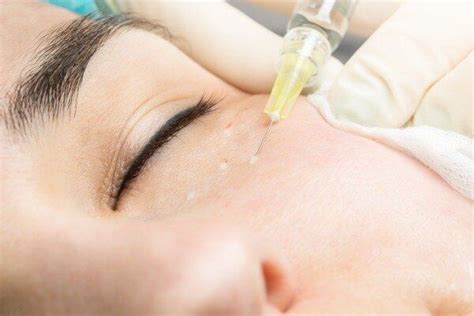 Mesotherapy vs Dermapen: A Comparison