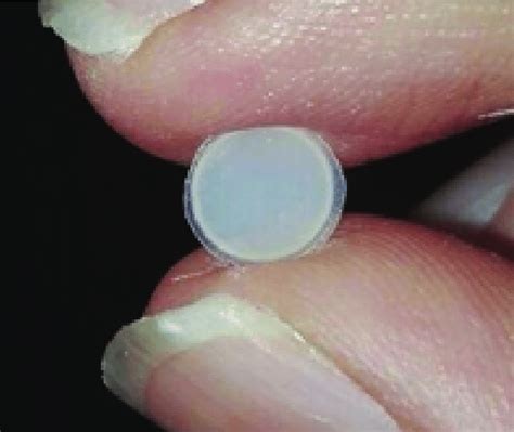 Composite resin disk. | Download Scientific Diagram