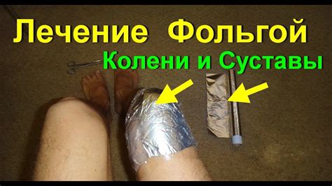 Лечение суставов фольгой.Фольга, как лечить суставы. Боли в коленях ...
