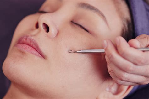 Did You Know Unbelievable Blackhead Removal 2024 Could Do THIS? Image 4