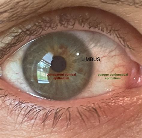 Cornea
