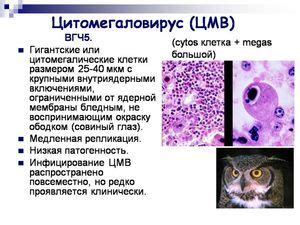 Citomegalovirus igg: klase i simptomi infekcije, što dokazuju rezultati ...