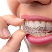 DR. SMILE съемные виниры