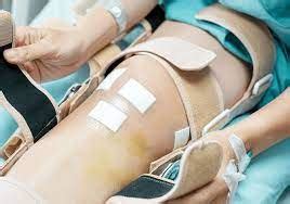 Stages Of Knee Replacement Surgery Recovery - Readella